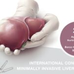 International Congress on Minimally Invasive Liver Surgery